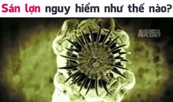 Sán lợn nguy hiểm như thế nào