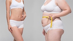 Chê bạn gái béo và cái kết đắng sau 2 năm